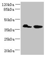 L3HYPDH / C14orf149 Antibody - Western blot All lanes: L3HYPDH antibody at 8µg/ml Lane 1: HepG2 whole cell lysate Lane 2: A549 whole cell lysate Secondary Goat polyclonal to rabbit IgG at 1/10000 dilution Predicted band size: 39 kDa Observed band size: 39 kDa