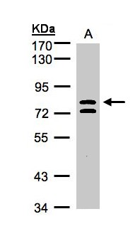 L3MBTL1 Antibody - Sample (30 ug whole cell lysate). A: HeLa S3. 7.5% SDS PAGE. L3MBTL antibody diluted at 1:1000