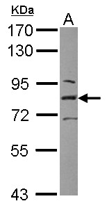 L3MBTL1 Antibody - Sample (30 ug of whole cell lysate) A: HeLa nucleus 7.5% SDS PAGE L3MBTL antibody diluted at 1:1000