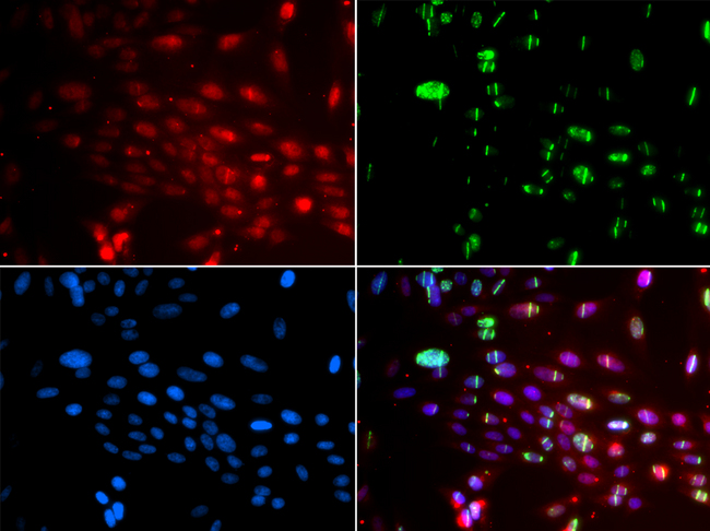 L3MBTL1 Antibody - Immunofluorescence analysis of GFP-RNF168 transgenic U2OS cells.