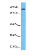 L3MBTL1 Antibody - Western blot of LMBL1 Antibody with human MCF7 Whole Cell lysate.  This image was taken for the unconjugated form of this product. Other forms have not been tested.