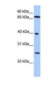 L3MBTL2 Antibody - L3MBTL2 antibody Western blot of HeLa lysate. This image was taken for the unconjugated form of this product. Other forms have not been tested.