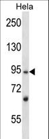 L3MBTL2 Antibody - L3MBTL2 Antibody western blot of HeLa cell line lysates (35 ug/lane). The L3MBTL2 antibody detected the L3MBTL2 protein (arrow).