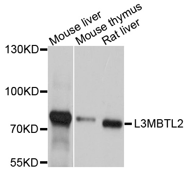 L3MBTL2 Antibody - Western blot analysis of extracts of various cell lines, using L3MBTL2 antibody at 1:1000 dilution. The secondary antibody used was an HRP Goat Anti-Rabbit IgG (H+L) at 1:10000 dilution. Lysates were loaded 25ug per lane and 3% nonfat dry milk in TBST was used for blocking. An ECL Kit was used for detection and the exposure time was 10s.