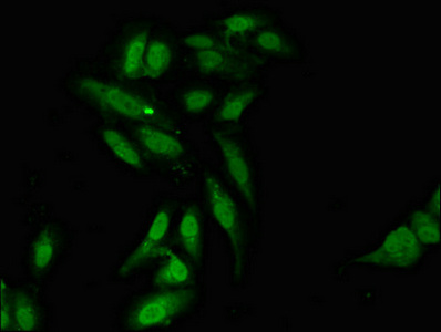 L3MBTL2 Antibody - Immunofluorescent analysis of Hela cells diluted at 1:100 and Alexa Fluor 488-congugated AffiniPure Goat Anti-Rabbit IgG(H+L)