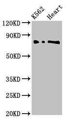 L3MBTL2 Antibody - Western Blot Positive WB detected in:K562 whole cell lysate,Rat heart tissue All Lanes:L3MBTL2 antibody at 3µg/ml Secondary Goat polyclonal to rabbit IgG at 1/50000 dilution Predicted band size: 80,70 KDa Observed band size: 80 KDa
