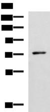 L3MBTL2 Antibody - Western blot analysis of Mouse thymus tissue lysate  using L3MBTL2 Polyclonal Antibody at dilution of 1:1000
