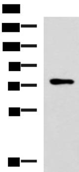 L3MBTL2 Antibody - Western blot analysis of Mouse thymus tissue lysate  using L3MBTL2 Polyclonal Antibody at dilution of 1:800