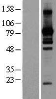 L3MBTL2 Protein - Western validation with an anti-DDK antibody * L: Control HEK293 lysate R: Over-expression lysate