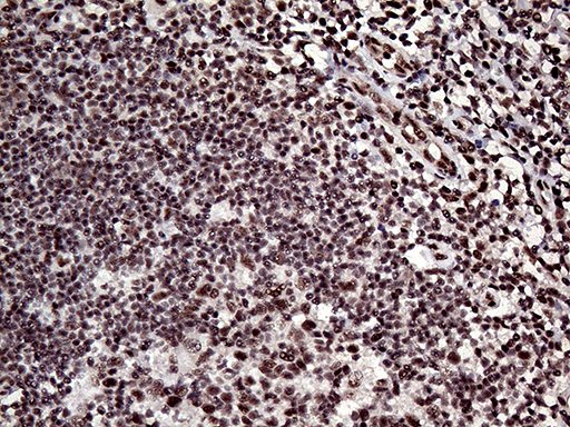 L3MBTL3 Antibody - Immunohistochemical staining of paraffin-embedded Human lymph node tissue within the normal limits using anti-L3MBTL3 mouse monoclonal antibody. (Heat-induced epitope retrieval by 1mM EDTA in 10mM Tris buffer. (pH8.5) at 120°C for 3 min. (1:1000)