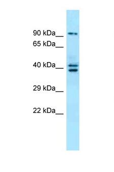 L3MBTL3 Antibody - L3MBTL3 antibody Western blot of Placenta lysate. Antibody concentration 1 ug/ml. This image was taken for the unconjugated form of this product. Other forms have not been tested.