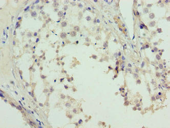 L3MBTL4 Antibody - Immunohistochemistry of paraffin-embedded human testis tissue using L3MBTL4 Antibody at dilution of 1:100