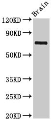 L3MBTL4 Antibody - Western Blot Positive WB detected in: Rat brain tissue All lanes: L3MBTL4 antibody at 3µg/ml Secondary Goat polyclonal to rabbit IgG at 1/50000 dilution Predicted band size: 72, 62 kDa Observed band size: 72 kDa