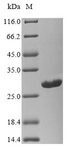 SARS-CoV Nucleoprotein Protein - (Tris-Glycine gel) Discontinuous SDS-PAGE (reduced) with 5% enrichment gel and 15% separation gel.