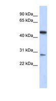 LACC1 Antibody - C13orf31 antibody Western blot of Fetal Lung lysate. This image was taken for the unconjugated form of this product. Other forms have not been tested.
