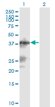 LACC1 Antibody - Western blot of C13orf31 expression in transfected 293T cell line by C13orf31 monoclonal antibody (M04), clone 2A1.
