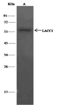 LACC1 Antibody - LACC1 was immunoprecipitated using: Lane A: 0.5 mg Jurkat Whole Cell Lysate. 4 uL anti-LACC1 rabbit polyclonal antibody and 15 ul of 50% Protein G agarose. Primary antibody: Anti-LACC1 rabbit polyclonal antibody, at 1:100 dilution. Secondary antibody: Clean-Blot IP Detection Reagent (HRP) at 1:500 dilution. Developed using the DAB staining technique. Performed under reducing conditions. Predicted band size: 47 kDa. Observed band size: 47 kDa.