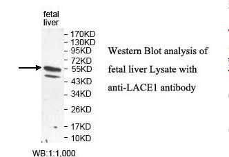 LACE1 Antibody