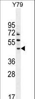 LACE1 Antibody - LACE1 Antibody western blot of Y79 cell line lysates (35 ug/lane). The LACE1 antibody detected the LACE1 protein (arrow).