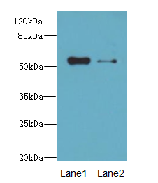LACE1 Antibody - Western blot. All lanes: LACE1 antibody at 6 ug/ml. Lane 1: Mouse kidney tissue. Lane 2: Mouse lung tissue. Secondary Goat polyclonal to Rabbit IgG at 1:10000 dilution. Predicted band size: 55 kDa. Observed band size: 55 kDa.
