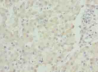 LACE1 Antibody - Immunohistochemistry of paraffin-embedded human liver tissue using antibody at dilution of 1:100.