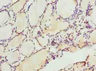 LACE1 Antibody - Immunohistochemistry of paraffin-embedded human thyroid tissue using antibody at dilution of 1:100.