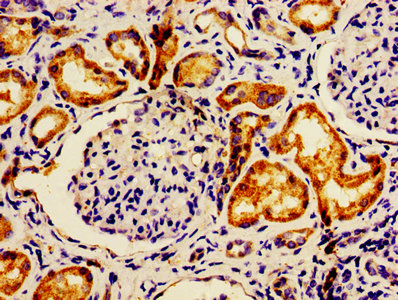 LACE1 Antibody - IHC image of LACE1 Antibody diluted at 1:600 and staining in paraffin-embedded human kidney tissue performed on a Leica BondTM system. After dewaxing and hydration, antigen retrieval was mediated by high pressure in a citrate buffer (pH 6.0). Section was blocked with 10% normal goat serum 30min at RT. Then primary antibody (1% BSA) was incubated at 4°C overnight. The primary is detected by a biotinylated secondary antibody and visualized using an HRP conjugated SP system.