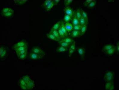 LACE1 Antibody - Immunofluorescence staining of HepG2 cells with LACE1 Antibody at 1:200, counter-stained with DAPI. The cells were fixed in 4% formaldehyde, permeabilized using 0.2% Triton X-100 and blocked in 10% normal Goat Serum. The cells were then incubated with the antibody overnight at 4°C. The secondary antibody was Alexa Fluor 488-congugated AffiniPure Goat Anti-Rabbit IgG(H+L).