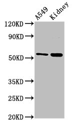 LACE1 Antibody - Western Blot Positive WB detected in: A549 whole cell lysate, Rat kidney tissue All lanes: LACE1 antibody at 3µg/ml Secondary Goat polyclonal to rabbit IgG at 1/50000 dilution Predicted band size: 55 kDa Observed band size: 55 kDa