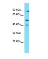 LACE1 Antibody - Western blot of LACE1 Antibody - N-terminal region with human THP-1 cells lysate.  This image was taken for the unconjugated form of this product. Other forms have not been tested.