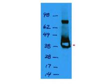 LacI / Lac Repressor Antibody - Anti-Lac I Antibody - Western Blot. Western blot of affinity purified anti-Lac I antibody shows detection of a 38 kD band corresponding to recombinant Lac I (arrowhead). The blot was blocked with 5% BLOTTO in TTBS overnight at 4C. Primary antibody was used at a 1:1000 dilution followed by reaction with a 1:10000 dilution of HRP goat anti-rabbit IgG. ECL was used for detection. Personal communication, S. Hughes & M. Abram, NCI, Bethesda, MD.