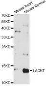 LACRT Antibody - Western blot analysis of extracts of various cell lines, using LACRT antibody at 1:3000 dilution. The secondary antibody used was an HRP Goat Anti-Rabbit IgG (H+L) at 1:10000 dilution. Lysates were loaded 25ug per lane and 3% nonfat dry milk in TBST was used for blocking. An ECL Kit was used for detection and the exposure time was 90s.