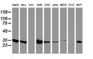 LACTB2 Antibody - Western blot of extracts (35ug) from 9 different cell lines by using anti-LACTB2 monoclonal antibody.