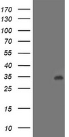 LACTB2 Antibody - HEK293T cells were transfected with the pCMV6-ENTRY control (Left lane) or pCMV6-ENTRY LACTB2 (Right lane) cDNA for 48 hrs and lysed. Equivalent amounts of cell lysates (5 ug per lane) were separated by SDS-PAGE and immunoblotted with anti-LACTB2.