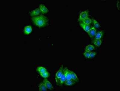 LACTB2 Antibody - Immunofluorescent analysis of HepG2 cells using LACTB2 Antibody at dilution of 1:100 and Alexa Fluor 488-congugated AffiniPure Goat Anti-Rabbit IgG(H+L)