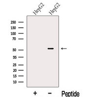 LACTB2 Antibody - Western blot analysis of extracts of HepG2 cells using LACTB antibody. The lane on the left was treated with blocking peptide.
