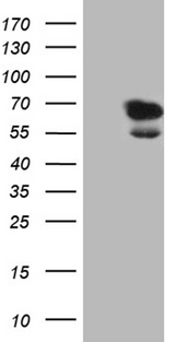 LAD1 Antibody - HEK293T cells were transfected with the pCMV6-ENTRY control. (Left lane) or pCMV6-ENTRY LAD1. (Right lane) cDNA for 48 hrs and lysed. Equivalent amounts of cell lysates. (5 ug per lane) were separated by SDS-PAGE and immunoblotted with anti-LAD1. (1:2000)