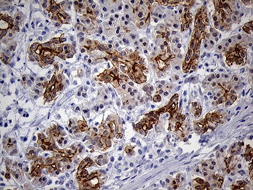 LAD1 Antibody - Immunohistochemical staining of paraffin-embedded Human pancreas tissue within the normal limits using anti-LAD1 mouse monoclonal antibody. (Heat-induced epitope retrieval by 1mM EDTA in 10mM Tris buffer. (pH8.5) at 120°C for 3 min. (1:500)