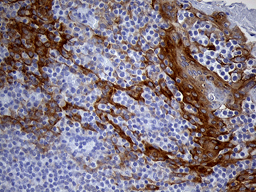 LAD1 Antibody - Immunohistochemical staining of paraffin-embedded Human tonsil within the normal limits using anti-LAD1 mouse monoclonal antibody. (Heat-induced epitope retrieval by 1mM EDTA in 10mM Tris buffer. (pH8.5) at 120°C for 3 min. (1:500)