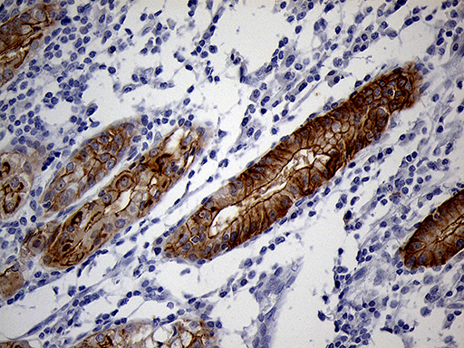 LAD1 Antibody - Immunohistochemical staining of paraffin-embedded Human gastric tissue within the normal limits using anti-LAD1 mouse monoclonal antibody. (Heat-induced epitope retrieval by 1mM EDTA in 10mM Tris buffer. (pH8.5) at 120°C for 3 min. (1:500)