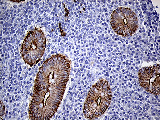 LAD1 Antibody - Immunohistochemical staining of paraffin-embedded Human appendix tissue within the normal limits using anti-LAD1 mouse monoclonal antibody. (Heat-induced epitope retrieval by 1mM EDTA in 10mM Tris buffer. (pH8.5) at 120°C for 3 min. (1:500)