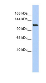 LAF4 / AFF3 Antibody - AFF3 antibody Western blot of HepG2 cell lysate. This image was taken for the unconjugated form of this product. Other forms have not been tested.