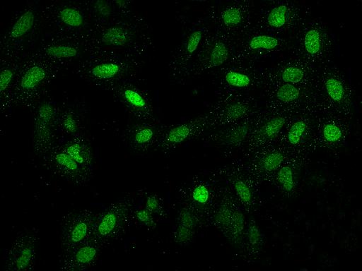 LAF4 / AFF3 Antibody - Immunofluorescence staining of AFF3 in U2OS cells. Cells were fixed with 4% PFA, permeabilzed with 0.1% Triton X-100 in PBS, blocked with 10% serum, and incubated with rabbit anti-Human AFF3 polyclonal antibody (dilution ratio 1:200) at 4°C overnight. Then cells were stained with the Alexa Fluor 488-conjugated Goat Anti-rabbit IgG secondary antibody (green). Positive staining was localized to Nucleus.