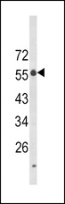 LAG3 Antibody - Western blot of LAG3 Antibody in K562 cell line lysates (35 ug/lane). LAG3 (arrow) was detected using the purified antibody.