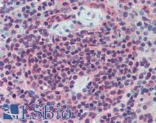 LAG3 Antibody - Human Spleen: Formalin-Fixed, Paraffin-Embedded (FFPE)