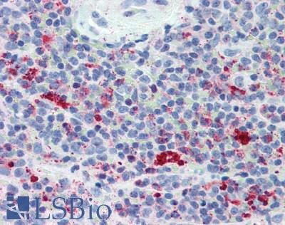 LAG3 Antibody - Human Spleen: Formalin-Fixed, Paraffin-Embedded (FFPE)