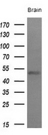 LAG3 Antibody - Western blot analysis of extracts. (10ug) from 1 human tissue by using anti-LAG3 monoclonal antibody at 1:200 dilution.