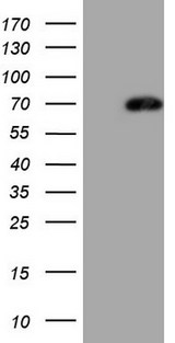 LAG3 Antibody - HEK293T cells were transfected with the pCMV6-ENTRY control. (Left lane) or pCMV6-ENTRY LAG3. (Right lane) cDNA for 48 hrs and lysed. Equivalent amounts of cell lysates. (5 ug per lane) were separated by SDS-PAGE and immunoblotted with anti-LAG3. (1:2000)