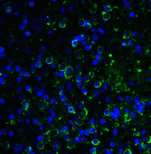 LAG3 Antibody - Immunofluorescence of LAG-3 in over human spleen tissue using LAG-3 Antibody at 10 ug/ml. Green: LAG3 Antibody [1G4] Blue: DAPI staining