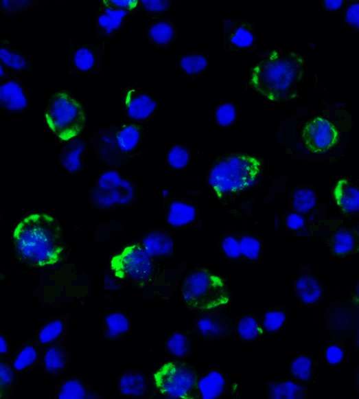 LAG3 Antibody - Immunofluorescence of LAG-3 in over expressing HEK293 cells using LAG-3 Antibody at 2 ug/ml. Green: LAG3 Antibody [1G4] Blue: DAPI staining